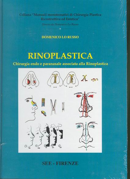 Rinoplastica - Chirurgia endo e paranasale associata alla Rinoplastica